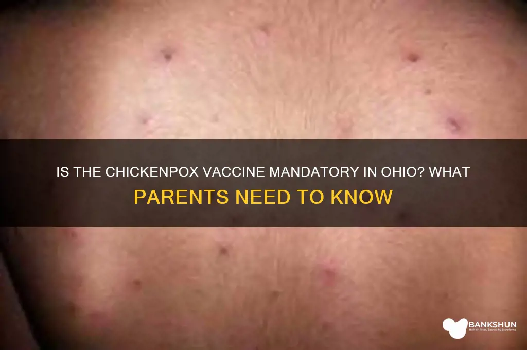 is the chickenpox vaccine mandatory in ohio