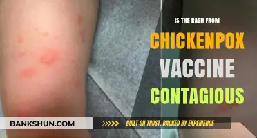 Is the Chickenpox Vaccine Rash Contagious? Facts and Safety Tips