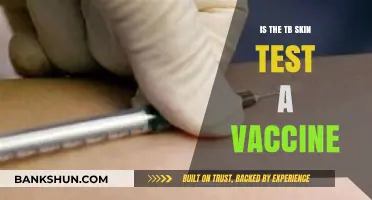 TB Skin Test vs. Vaccine: Understanding the Key Differences