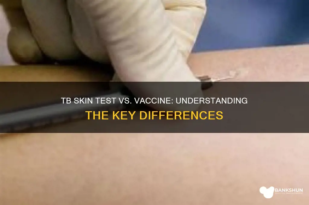 is the tb skin test a vaccine