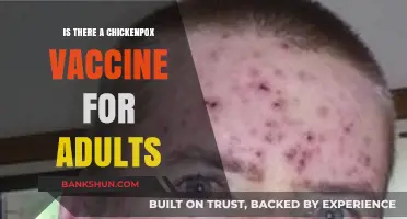 Adult Chickenpox Vaccine: Availability, Benefits, and Who Should Get It