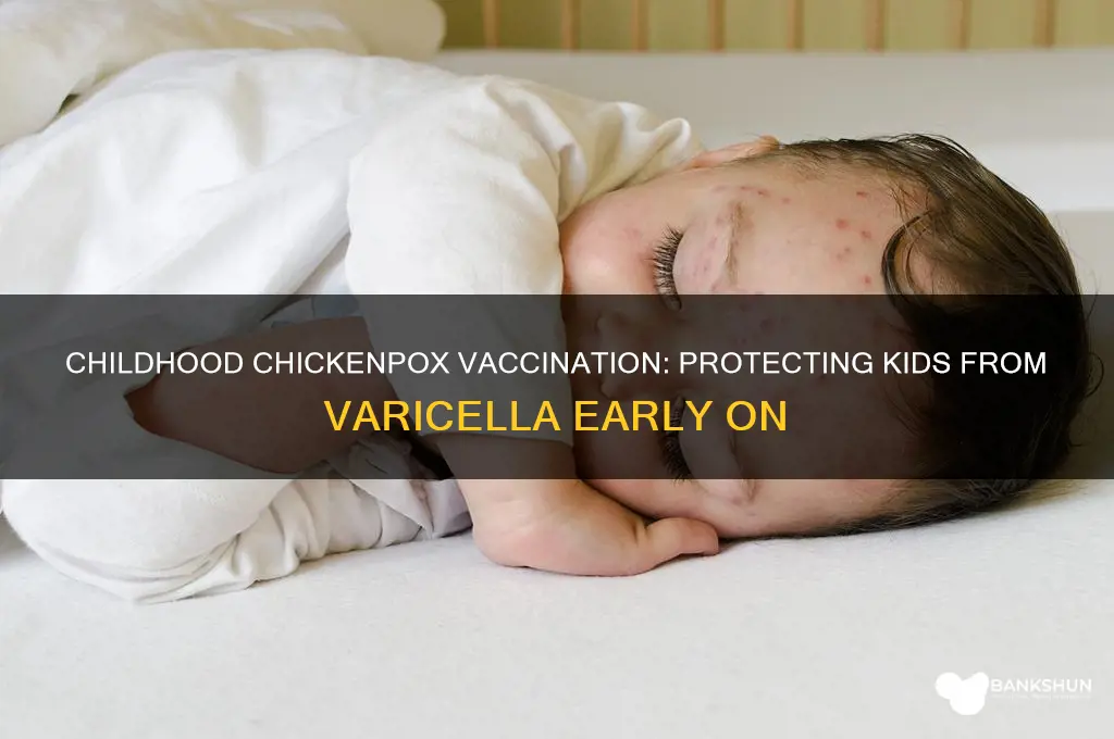 is there a childhood chicken pox vaccination