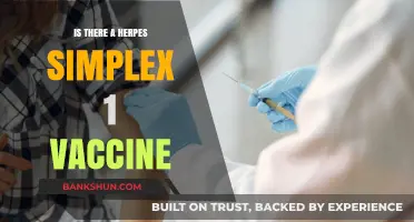 Exploring the Development of a Herpes Simplex 1 Vaccine: Current Status