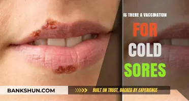 Cold Sores: Exploring Vaccination Options for Prevention and Treatment