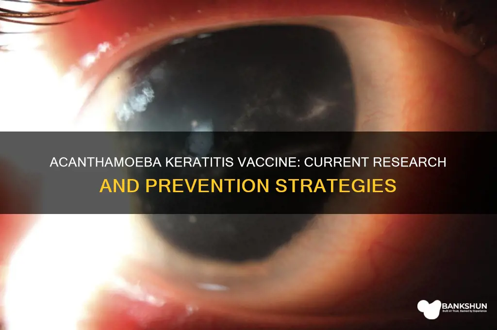 is there a vaccine for acanthamoeba keratitis