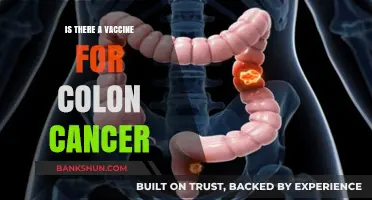 Exploring the Latest Research: Is There a Vaccine for Colon Cancer?