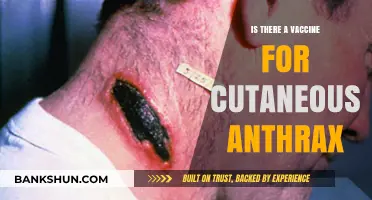 Cutaneous Anthrax Vaccine: Availability, Effectiveness, and Prevention Explained