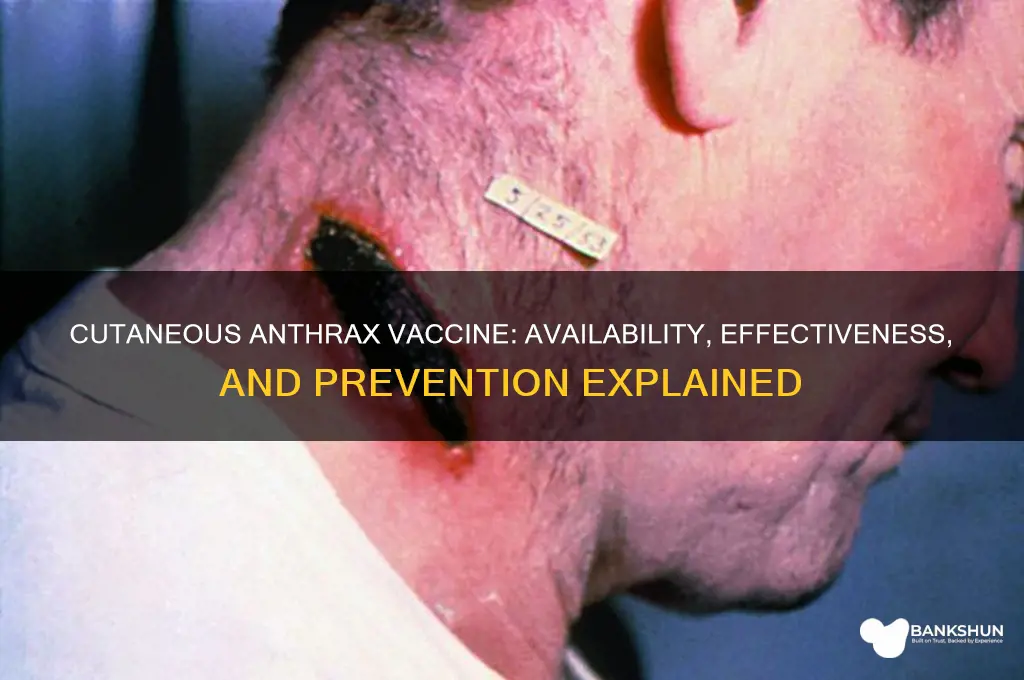 is there a vaccine for cutaneous anthrax