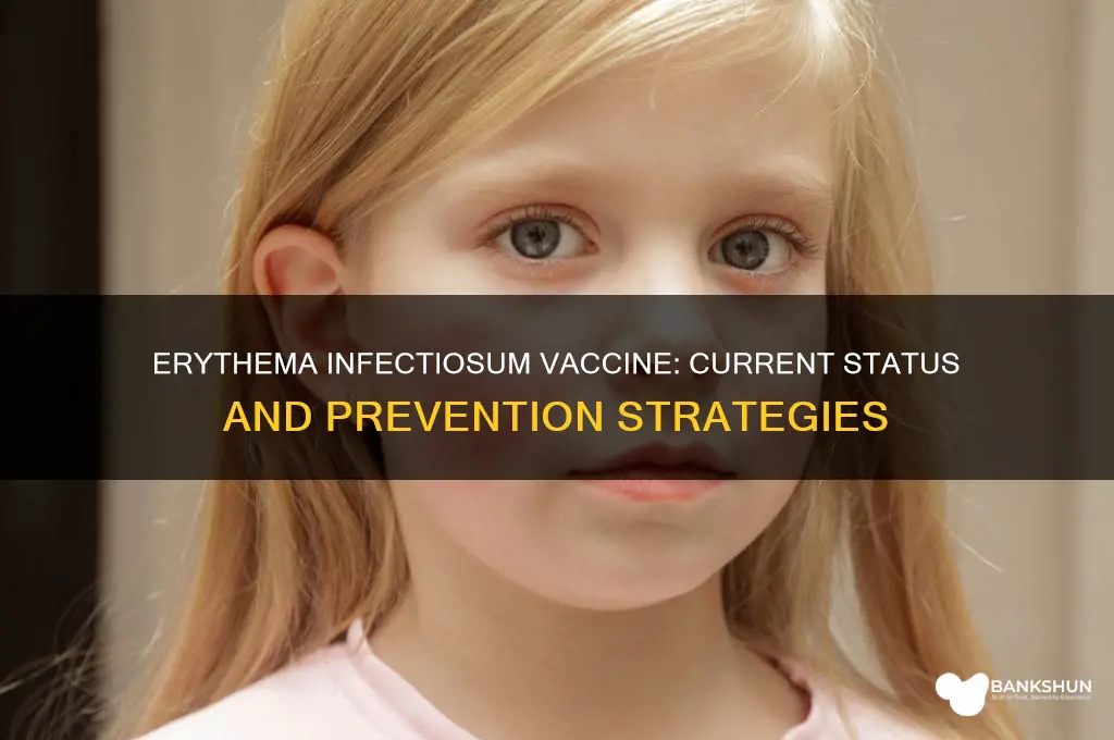 is there a vaccine for erythema infectiosum
