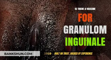 Exploring Treatment Options: Is There a Vaccine for Granuloma Inguinale?