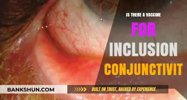 Exploring Vaccine Options for Inclusion Conjunctivitis: Facts and Insights