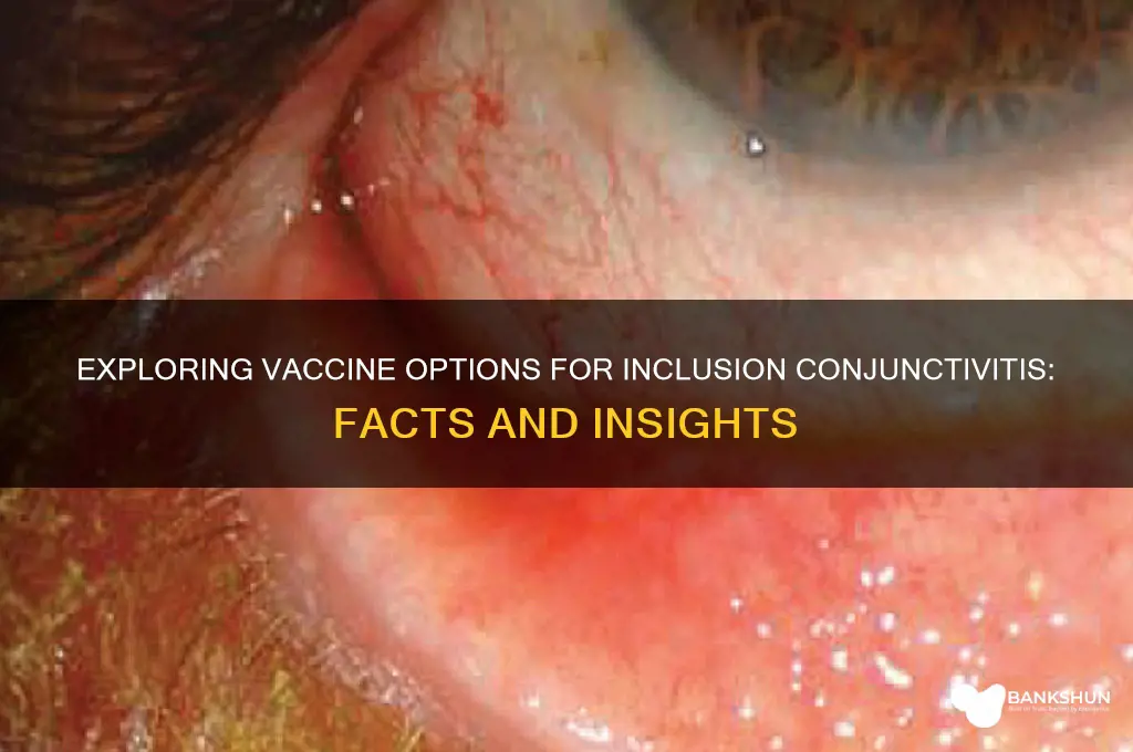 is there a vaccine for inclusion conjunctivitis