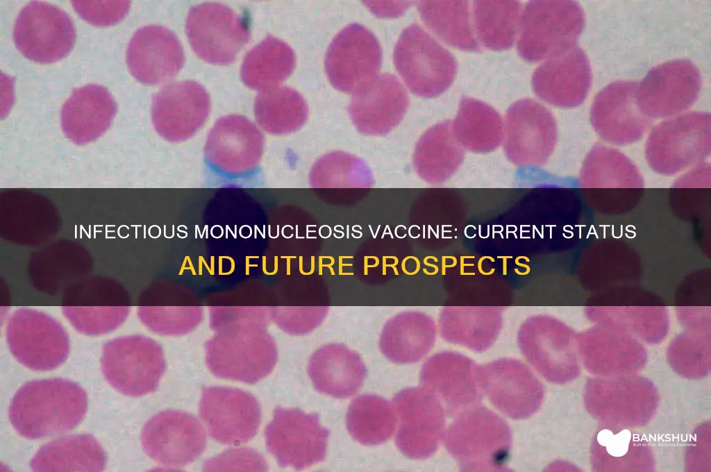 is there a vaccine for infectious mononucleosis