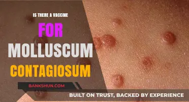 Exploring Molluscum Contagiosum: Vaccine Availability and Prevention Strategies