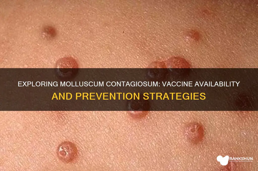 is there a vaccine for molluscum contagiosum