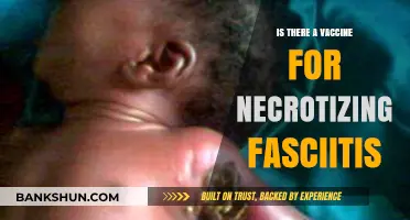 Necrotizing Fasciitis Vaccine: Current Status and Prevention Strategies