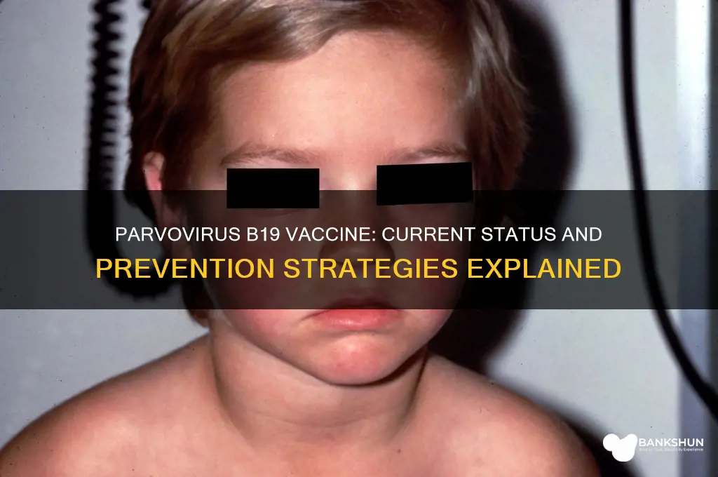 is there a vaccine for parvovirus b19