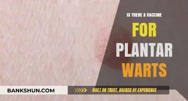 Can Vaccines Prevent or Treat Plantar Warts? Exploring the Options