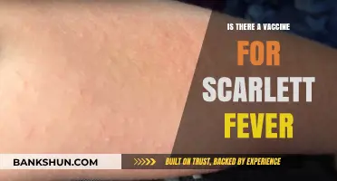 Scarlet Fever Vaccine: Current Status and Prevention Strategies Explained