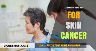 Exploring the Possibility: Is There a Vaccine for Skin Cancer?