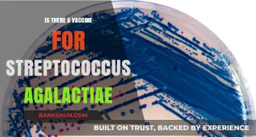 Streptococcus Agalactiae Vaccine: Current Status and Future Prospects