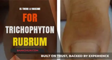 Trichophyton Rubrum Vaccine: Current Research and Treatment Options Explained
