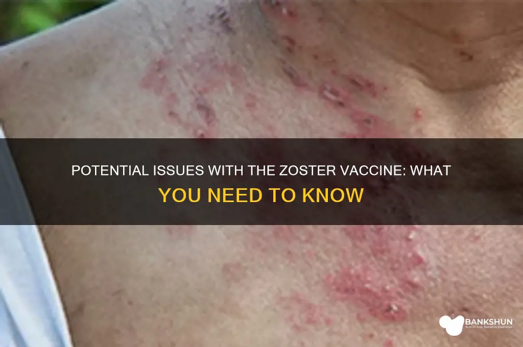 is there problems with the zoster vaccine