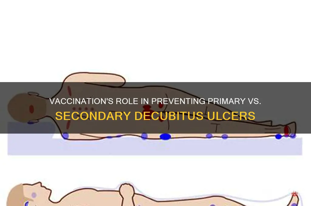 is vaccination primary or secondary decubitus ulcer