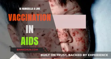 Varicella Live Vaccine Safety in AIDS Patients: What You Need to Know