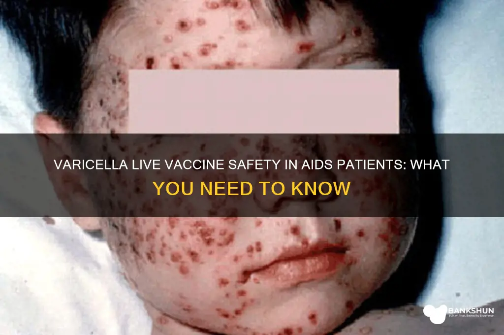 is varicella a live vaccination in aids