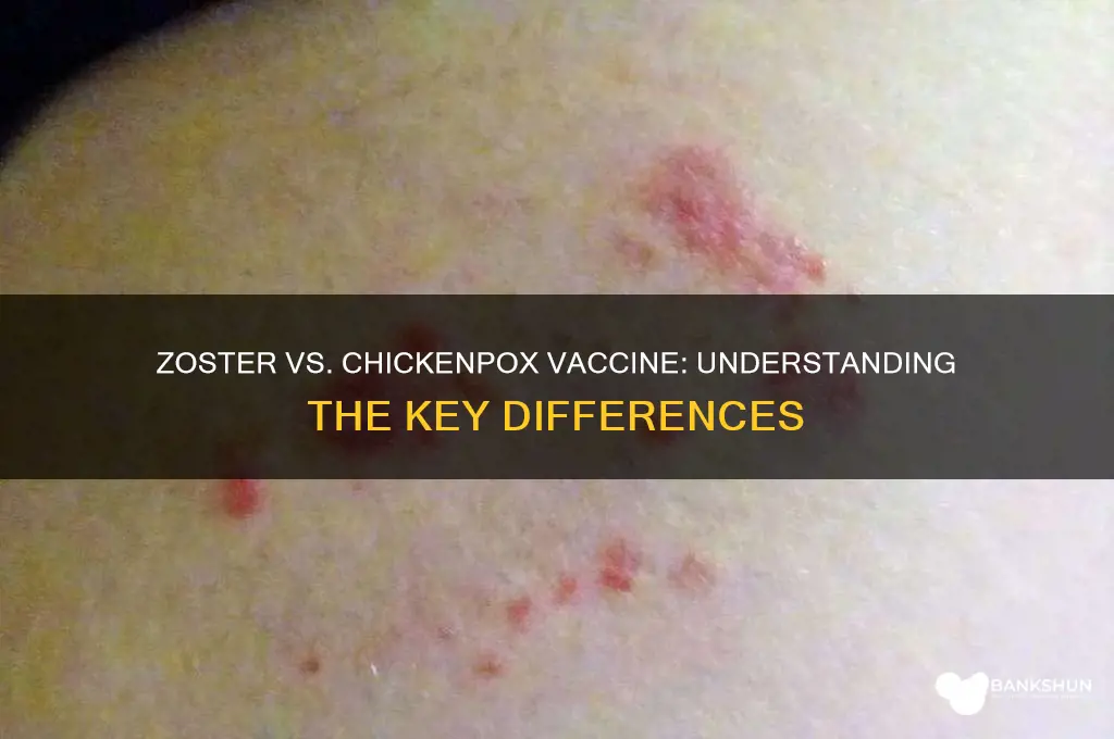 is zoster vaccine different from chickenpox vaccine