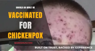 Adult Chickenpox Vaccination: Essential Protection or Optional Prevention?