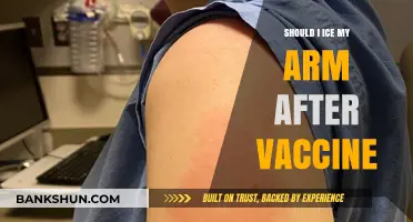 Should You Ice Your Arm After a Vaccine? Expert Tips