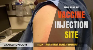 Should You Ice Your Vaccine Injection Site? Expert Advice and Tips
