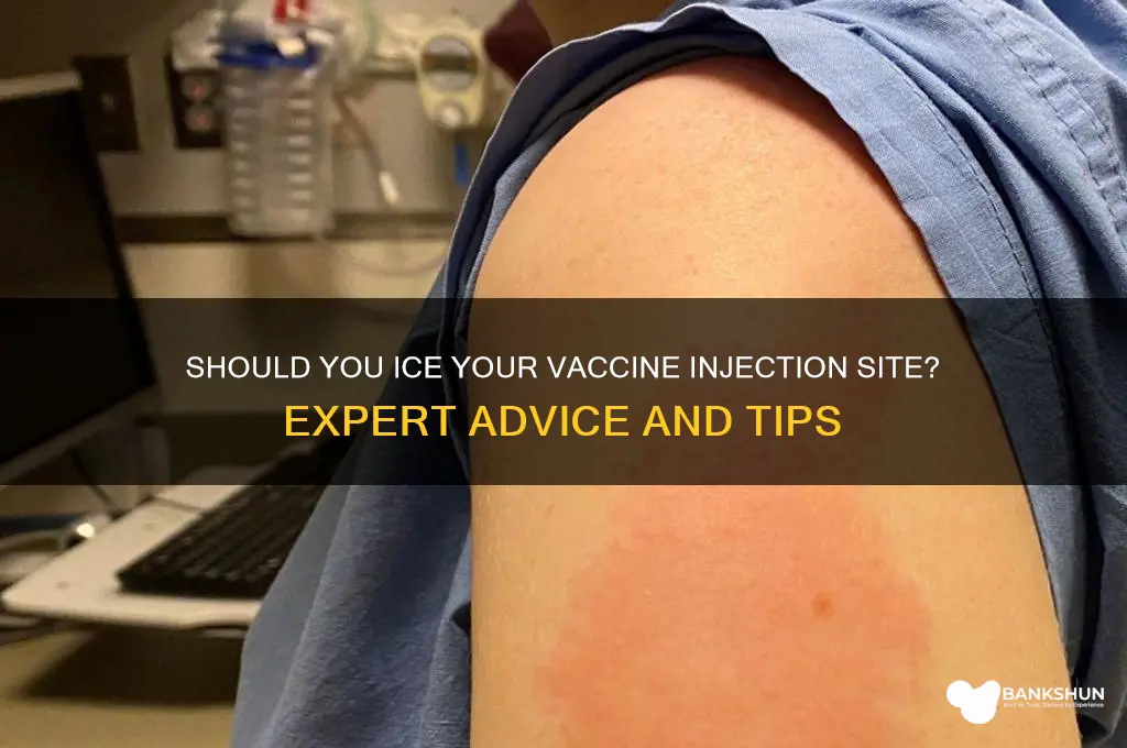 should i ice my vaccine injection site