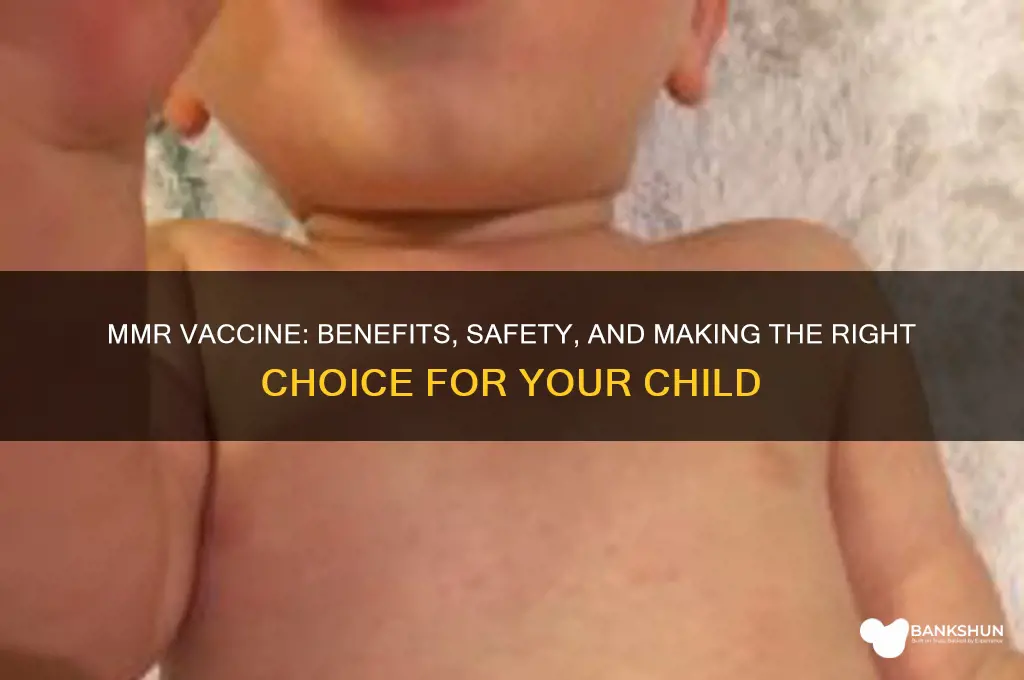 should i vaccinate my child with mmr