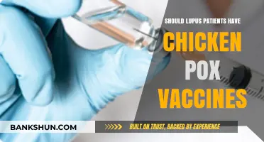 Lupus and Chickenpox Vaccines: Safety, Risks, and Expert Recommendations