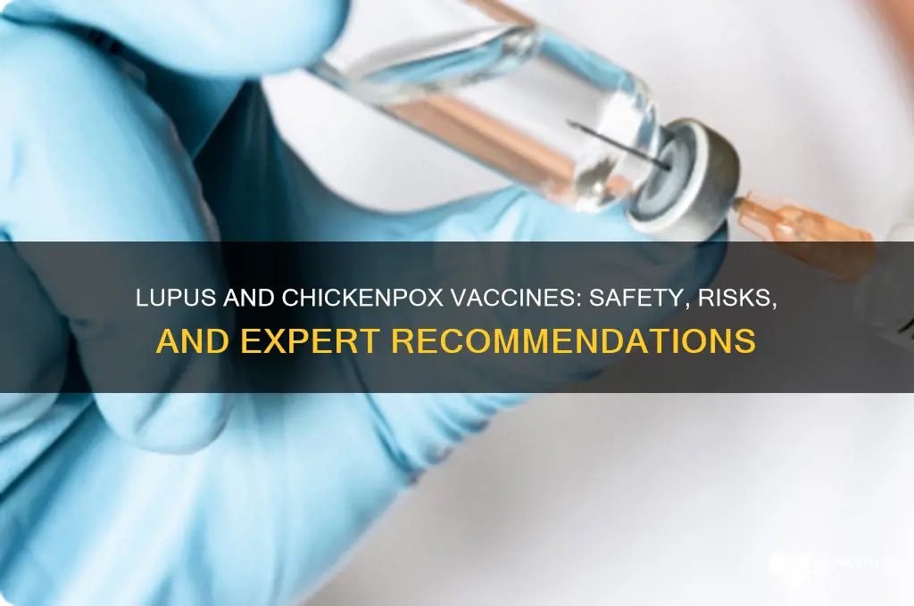 should lupus patients have chicken pox vaccines