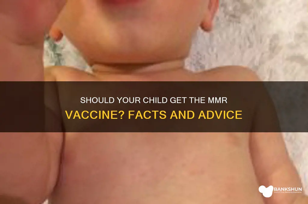 should my child have the mmr vaccine