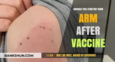 Post-Vaccine Arm Stretching: Benefits, Risks, and Expert Recommendations