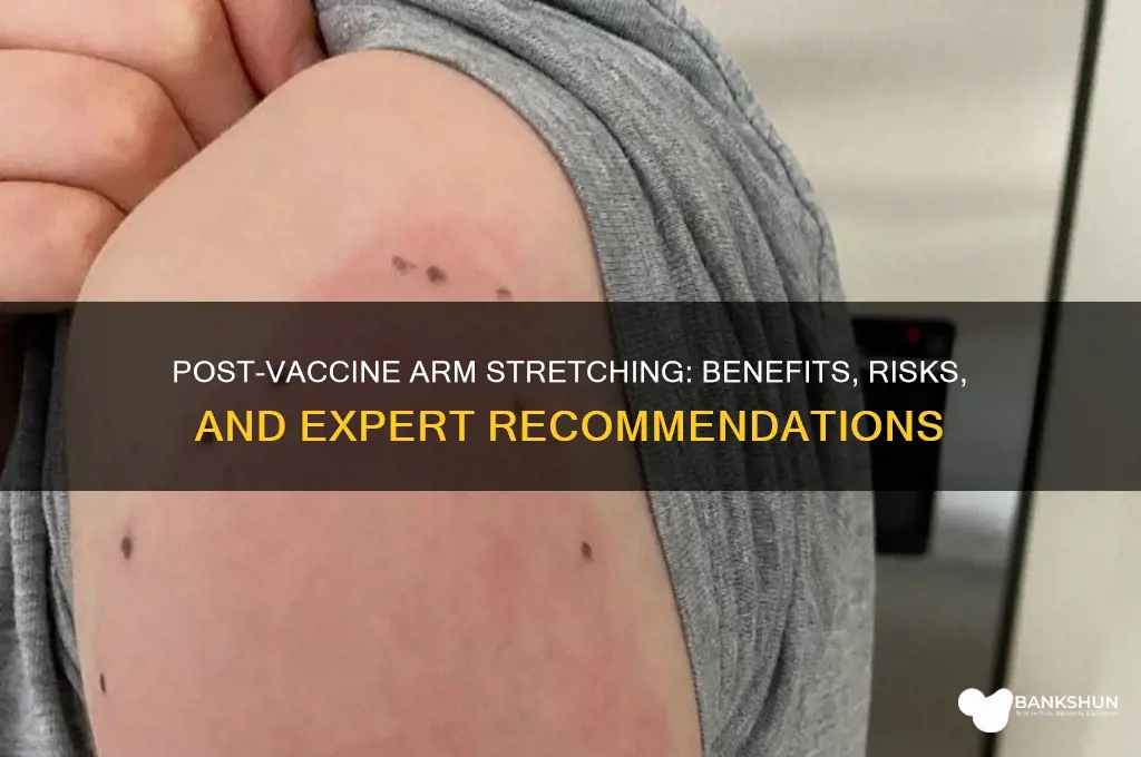 should you stretch your arm after vaccine