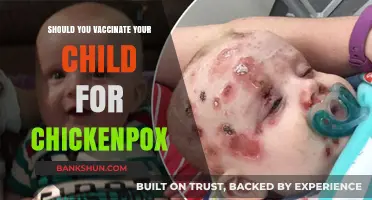 Chickenpox Vaccination for Kids: Benefits, Risks, and Parent's Guide