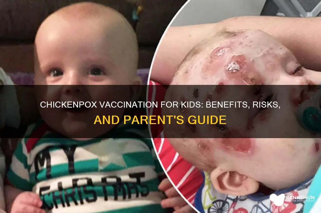 should you vaccinate your child for chickenpox