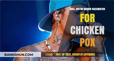 Justin Bieber's Chicken Pox Vaccination: Fact or Fiction?