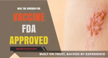 Was the Chicken Pox Vaccine FDA Approved? Uncovering the Facts