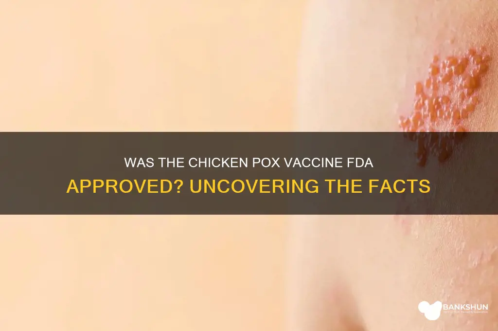 was the chicken pox vaccine fda approved