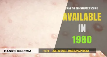 Chickenpox Vaccine in 1980: Was It Available Then?