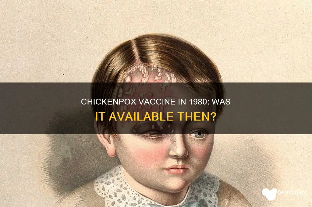 was the chickenpox vaccine available in 1980