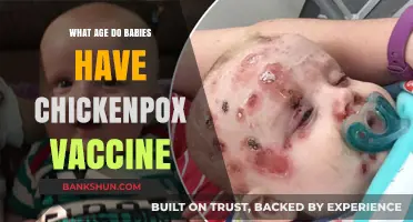 When Should Babies Get the Chickenpox Vaccine: A Guide