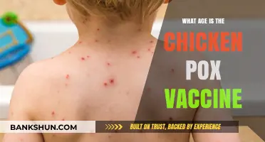 Chickenpox Vaccine: Ideal Age for Immunization and Protection